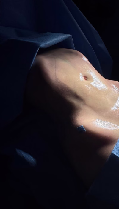 Cirugía de Lipoescultura & Tecnologías en Clínica Danas